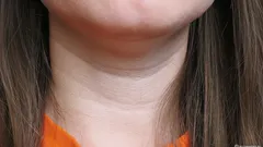 Det avslöjar din ålder direkt: så här blir du av med halsringarna